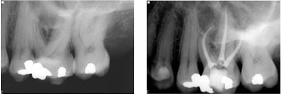 clinical-cases-endo61-1 Clinical Cases 1