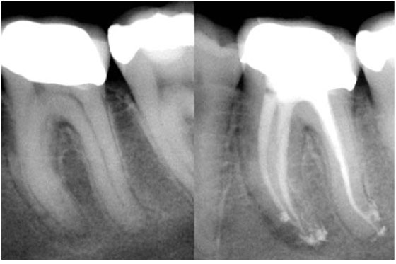 clinical-cases-endo61-2