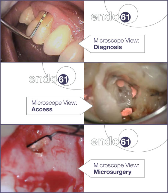 Operating Microscope Views